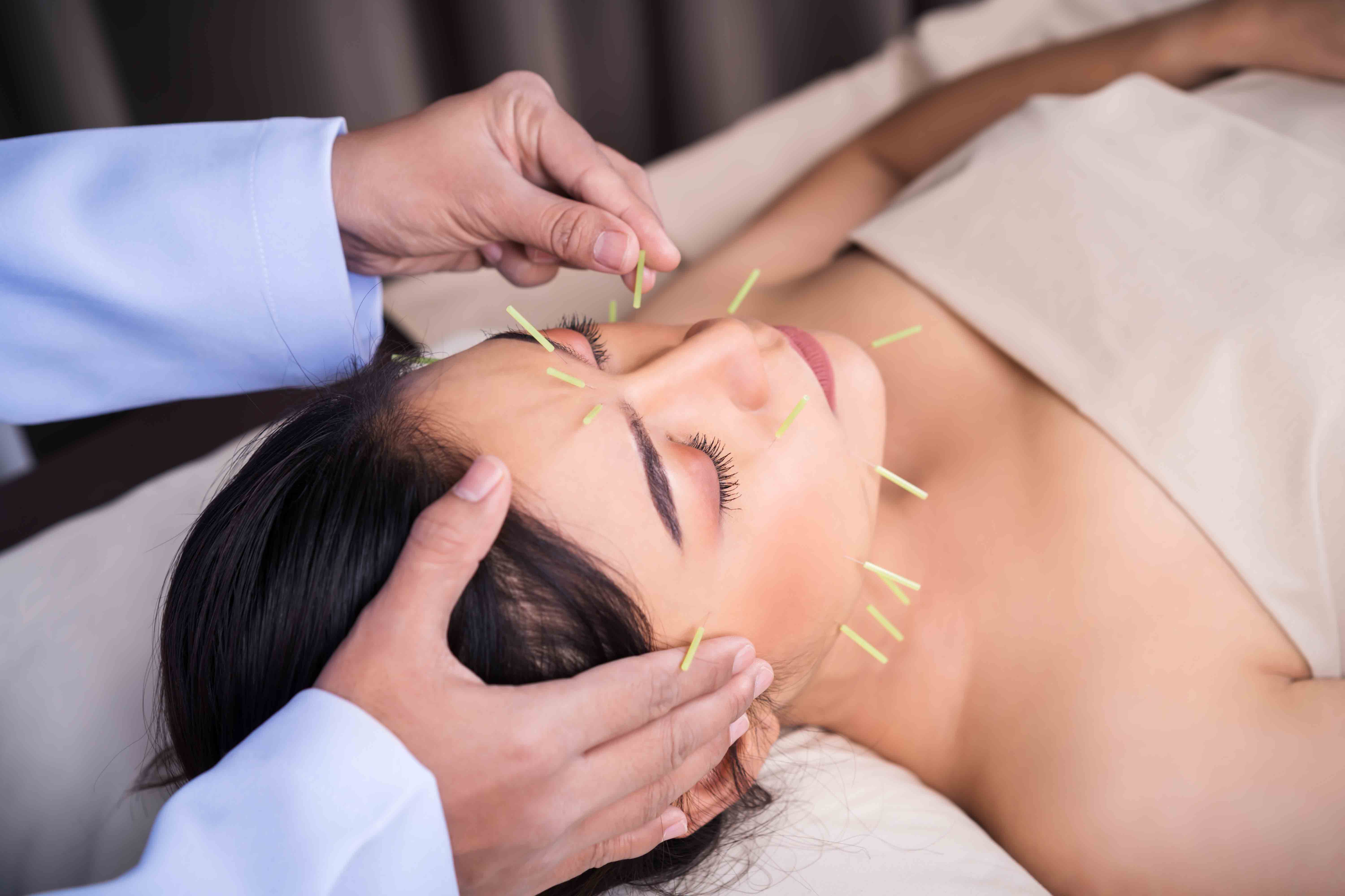 Akupunktur kecantikan, juga dikenal sebagai akupunktur kosmetik atau facial acupuncture,  dirancang untuk meningkatkan kesehatan kulit dan memperbaiki penampilan wajah. 